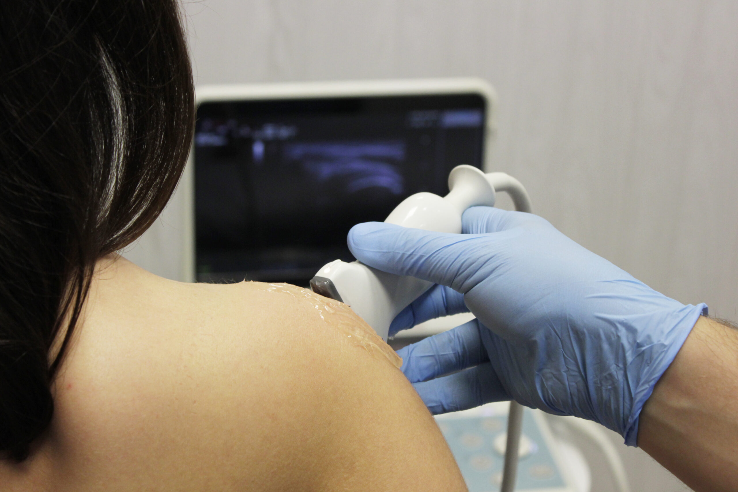 Servicio de Ecografía Musculoesquelética